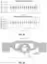 Fig. 09 - Mechanical strain amplifying transducer