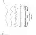 Fig. 06 - Fourier domain dynamic correction method for complex optical fringes in laser spectrometers