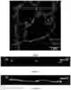 Fig. 14 - Multi-color imaging using salvaged fluorescence