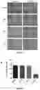 Fig. 11 - Dock derived compound against laminin receptor (37 LR) and uses thereof
