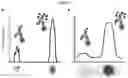 Fig. 05 - TARGET DETECTION USING A MONOVALENT ANTIBODY