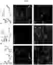 Fig. 06 - TARGET DETECTION USING A MONOVALENT ANTIBODY