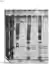 Fig. 13 - MMP-8 activation product, its determination and use