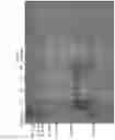 Fig. 14 - MMP-8 activation product, its determination and use