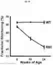 Fig. 03 - Use of IGFBP-7 in the assessment of heart failure