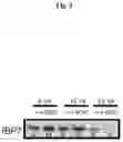 Fig. 05 - Use of IGFBP-7 in the assessment of heart failure