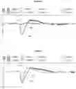 Fig. 06 - Electronic dosimeter for alarm generation in pulsed radiation fields