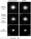 Fig. 14 - Systems and methods for instant total internal reflection fluorescence/ structured illumination microscopy