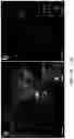 Fig. 15 - Systems and methods for instant total internal reflection fluorescence/ structured illumination microscopy