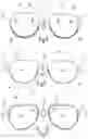 Fig. 02 - Two-piece Spectacles Frame Fitted with a Fixing Device for a Pair of Lenses