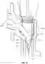 Fig. 13 - Fluid control valve having discrete flow channels arranged to equalize the velocity of fluid at the perimeter of the valve port