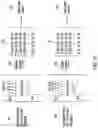 Fig. 15 - Systems and methods for sound enhancement in audio systems