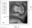 Fig. 06 - Navigating among images of an object in 3D space