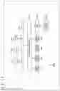 Fig. 16 - Image processing apparatus and method for suppressing overlap blur and individual blur from projection images using an inverted filter