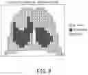 Fig. 10 - Medical image processing apparatus, medical image processing system, and medical image processing method