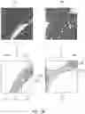 Fig. 04 - Computer aided method and electrical device for analyzing fibrosis