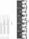 Fig. 06 - Medical image segmentation from raw data using a deep attention neural network