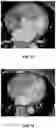 Fig. 18 - Systems and methods for image segmentation