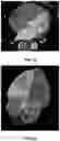 Fig. 22 - Systems and methods for image segmentation