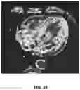 Fig. 23 - Systems and methods for image segmentation