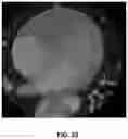 Fig. 24 - Systems and methods for image segmentation