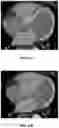 Fig. 26 - Systems and methods for image segmentation