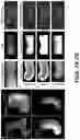 Fig. 08 - METHOD FOR DEFORMABLE 3D-2D REGISTRATION USING MULTIPLE LOCALLY RIGID REGISTRATIONS