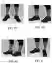Fig. 23 - Method and system of virtual footwear try-on with improved occlusion
