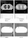 Fig. 08 - Systems and methods for iterative reconstruction