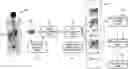 Fig. 01 - Interactive targeted ultrafast reconstruction in emission and transmission tomography