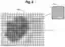 Fig. 05 - Method and system for assisting pathologist identification of tumor cells in magnified tissue images
