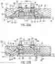 Fig. 06 - Electronics package with integrated interconnect structure and method of manufacturing thereof