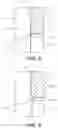 Fig. 04 - Electrostatic chuck assembly having a dielectric filler