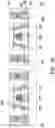 Fig. 12 - Semiconductor chip, package structure, and pacakge-on-package structure
