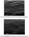 Fig. 14 - Microporous membranes, separators, lithium batteries, and related methods