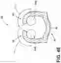 Fig. 10 - Terminal assembly and method