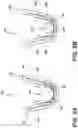 Fig. 16 - Terminal assembly and method