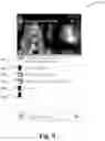 Fig. 09 - System and method of embedding rich media into text messages
