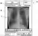 Fig. 01 - RADIATION IMAGE CAPTURING APPARATUS AND RADIATION IMAGE CAPTURING SYSTEM
