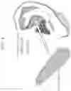Fig. 05 - Wearable device