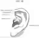 Fig. 24 - Wearable device
