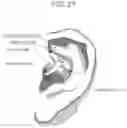 Fig. 25 - Wearable device