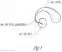 Fig. 02 - Hearing aid with distributed processing in ear piece