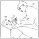 Fig. 01 - Impression procedure
