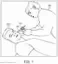 Fig. 02 - Impression procedure