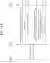 Fig. 14 - Method and apparatus for performing EDT