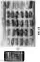 Fig. 10 - Peanut maturity grading systems and methods