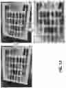 Fig. 11 - Peanut maturity grading systems and methods