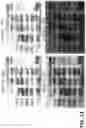 Fig. 12 - Peanut maturity grading systems and methods