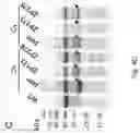 Fig. 11 - METHOD FOR REDUCING CONTAMINATION OF AN OBJECT WITH CLOSTRIDIUM